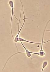 Sperm Cells